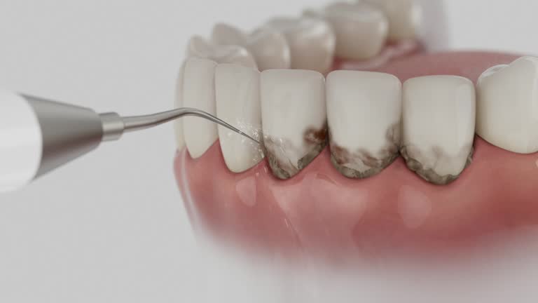 Trusted Wisdom Tooth Removal service in Albion, IL - Dentist Open Now